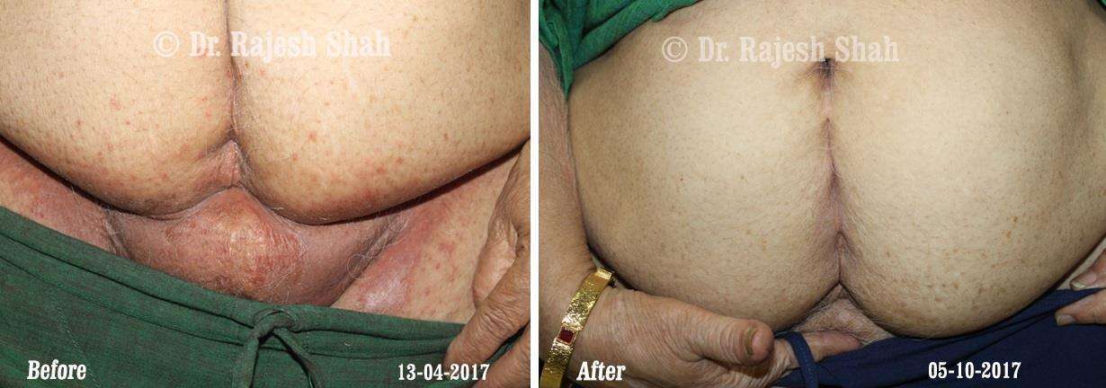 lifeforce homeopathy case-photos